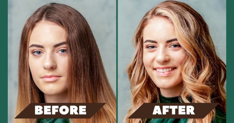 tretinoin before and after