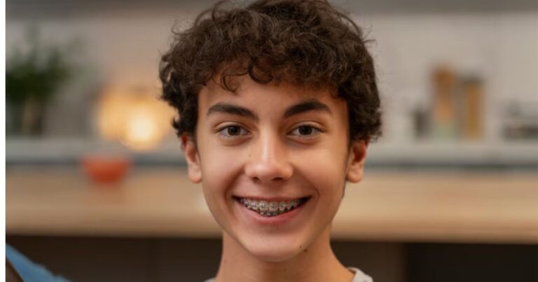 braces vs lingual braces